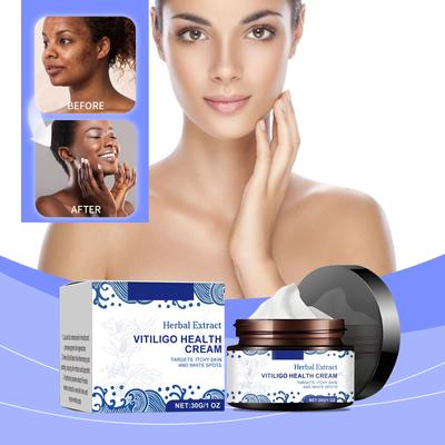 Vitiligo Sağlık Kremi, Vitiligo Yatıştırıcı Krem, Vitiligo Repigmentasyon Kremi, Yüz İçin Vitiligo Kremi, Beyaz Lekeler İçin Vitiligo Kremi