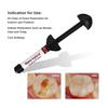 Niceden Dental Composite Flowable Resin Oral Filling Resin Materials Light Cure Dentistry Filling Consumables