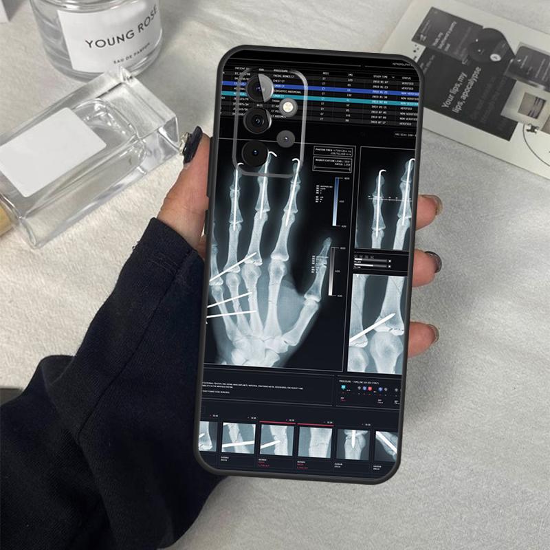 

Radiological Human Organs Skeleton Case For Samsung Galaxy A55 A35 A15 A52 A32 A12 A16 A26 A36 A56 A53 A33 A13 A14 A34 A54 A17 Samsung A72
