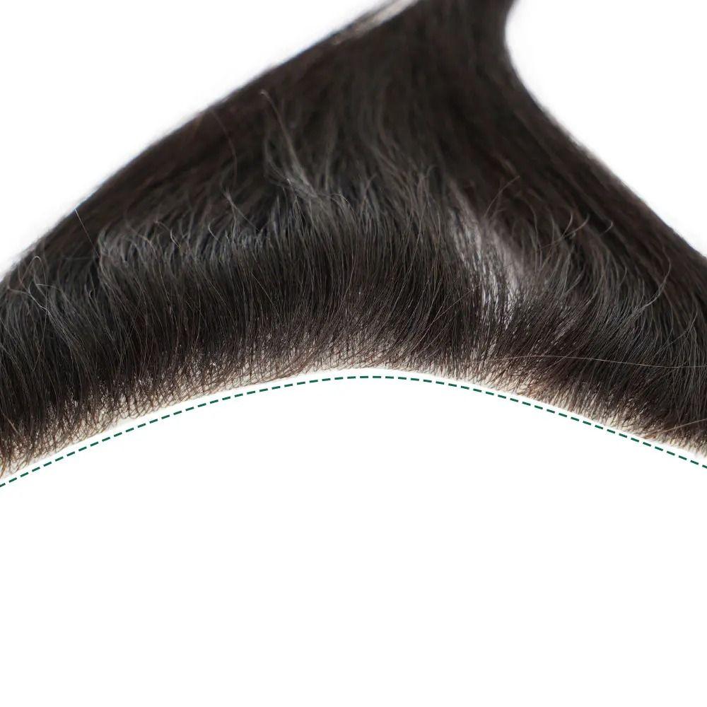 Seamless Natural Human Hair Patch Forehead Biological Scalp Patch  for Baldness Frontline