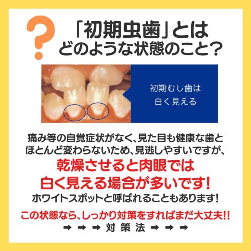 Smile Cosmetic Whitening Paste, 85ml X 3 Bottles, Contains 1450ppm Fluoride, Prevents Cavities, Whitens Teeth, and Reduces Bad Breath