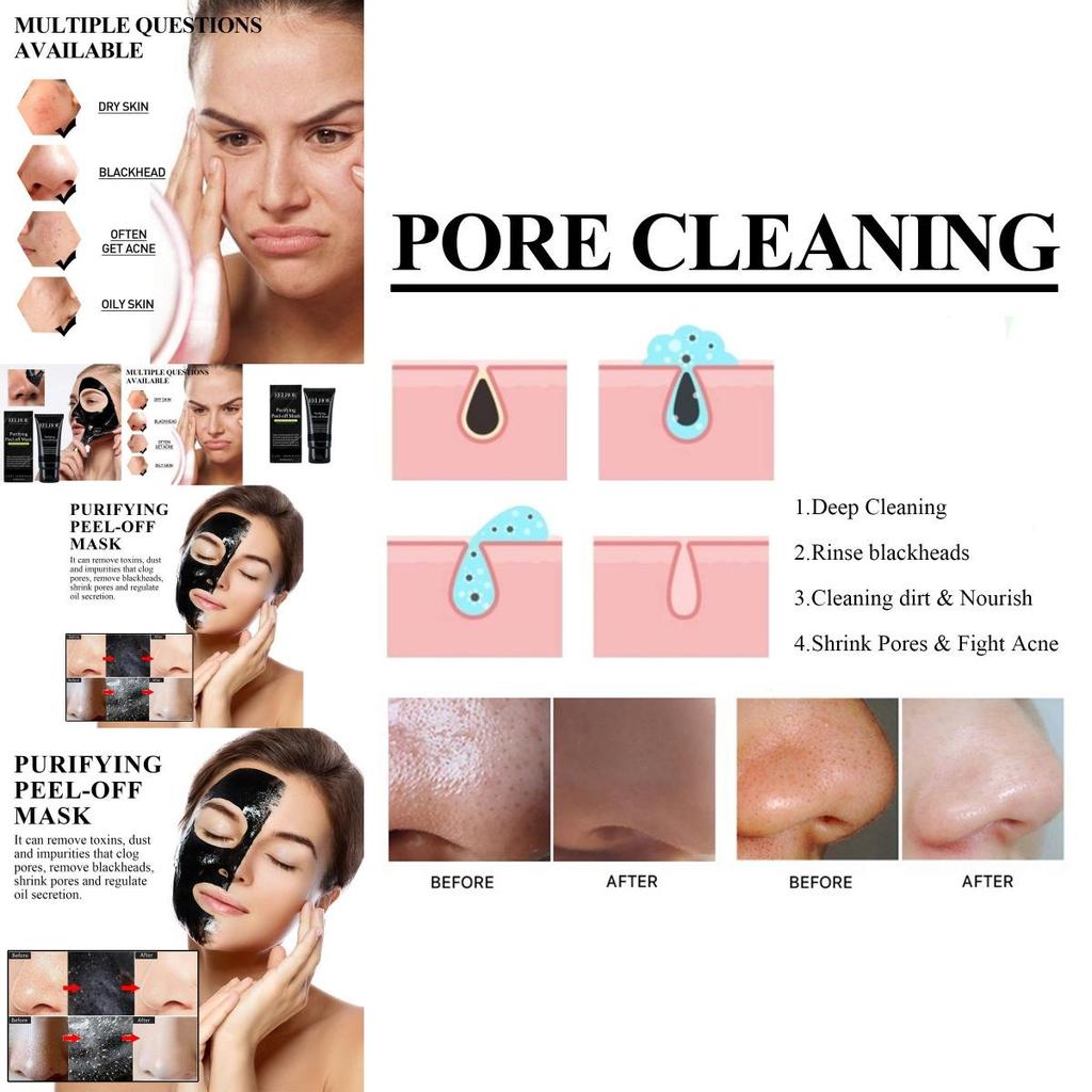 Eelhoe Blackhead Removal Pore Minimizing Mask For Deep Cleansing And Smooth Skin