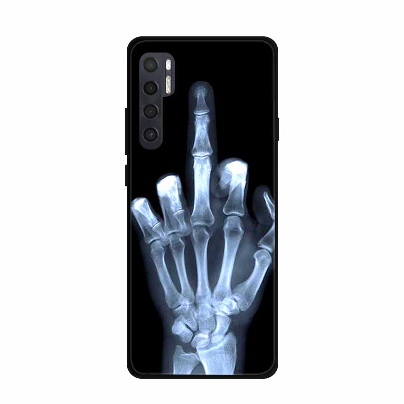 

For TCL 20 Pro 5G Cases T810H 6.67 Marble Soft TPU Silicone Back Covers for TCL 20 Pro 5G TCL20Pro 20Pro Phone Cases Fundas Bag TCL 20 Pro 5G