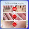 Anti Dry Crack Foot Cream Prevent Cracking Repair Cream Dryness Heel  Exfoliating Remove Dead Repair Cream,Traditional Chinese Cosmetics,plaster