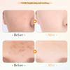 Vitamin C cotton tablets, salicylic acid skin rejuvenation mask skin care products