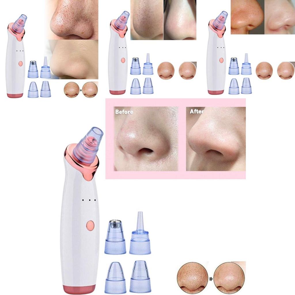 2020 Model Electric Blackhead Vacuum Cleaner For Deep Pore Cleansing And Care