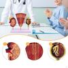Human Kidney Model,Biology Demonstration,Assisted Dissection,PVC Organs Nephron and Glomerulus Model