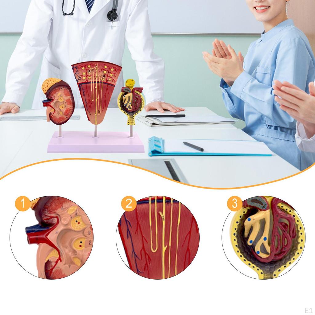 Human Kidney Model,Biology Demonstration,Assisted Dissection,PVC Organs Nephron and Glomerulus Model