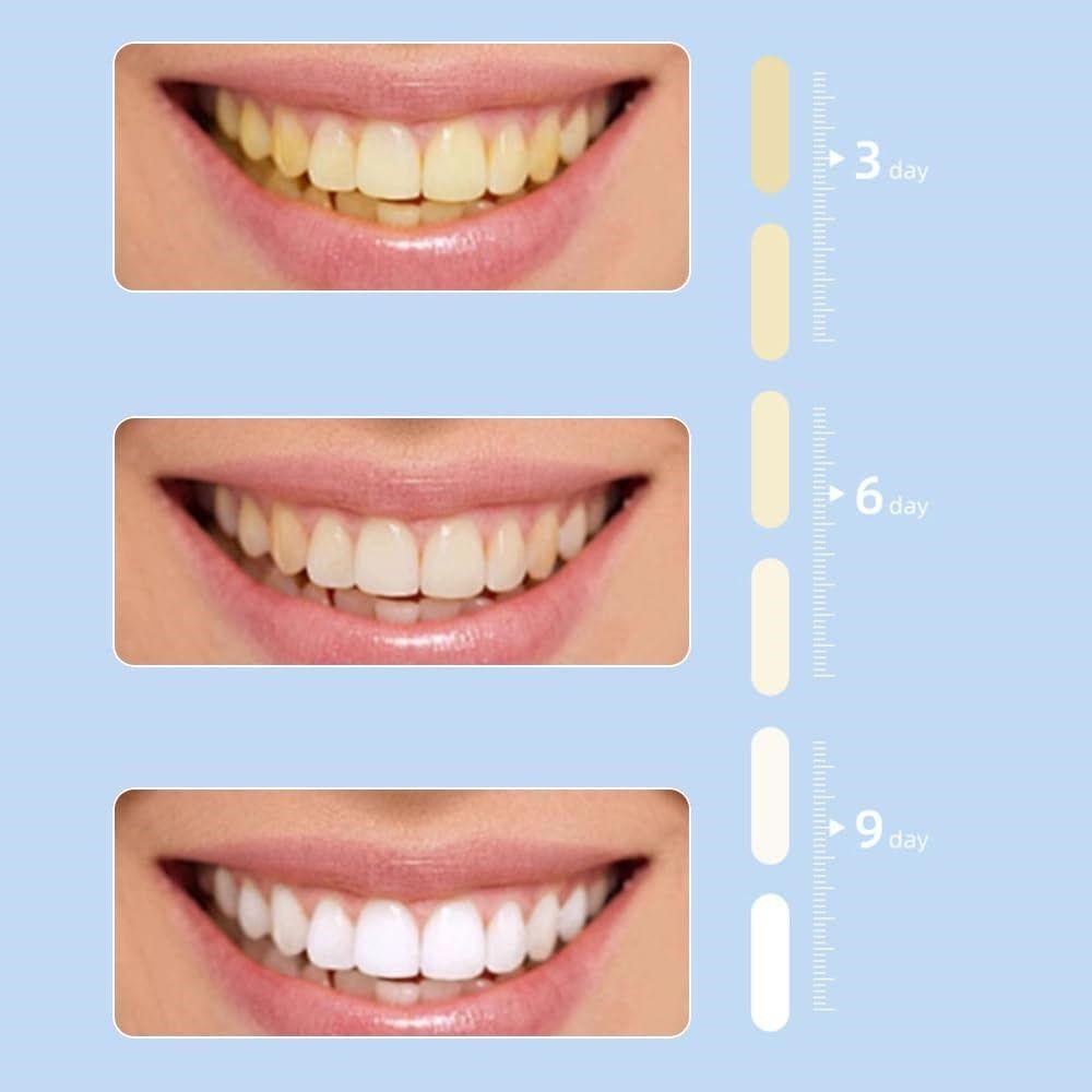 USB Rechargeable U-Shaped Electric Toothbrush Waterproof Teeth Brush  Professional Use