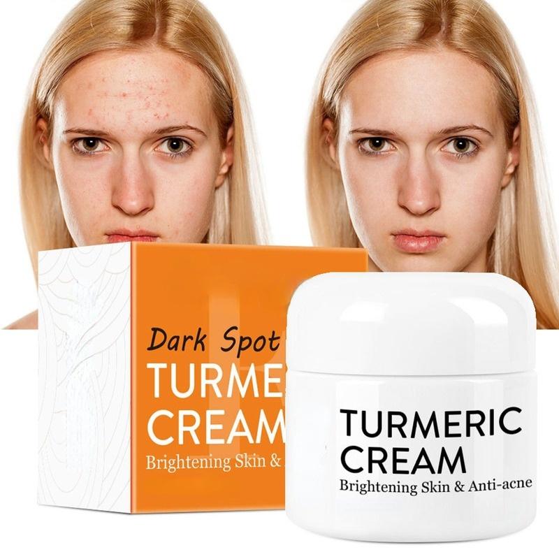 Herb Kurkum näokreem parandab akne arme Tumedate laikude niisutaja valgendav helendav akne vastu Nahahooldus