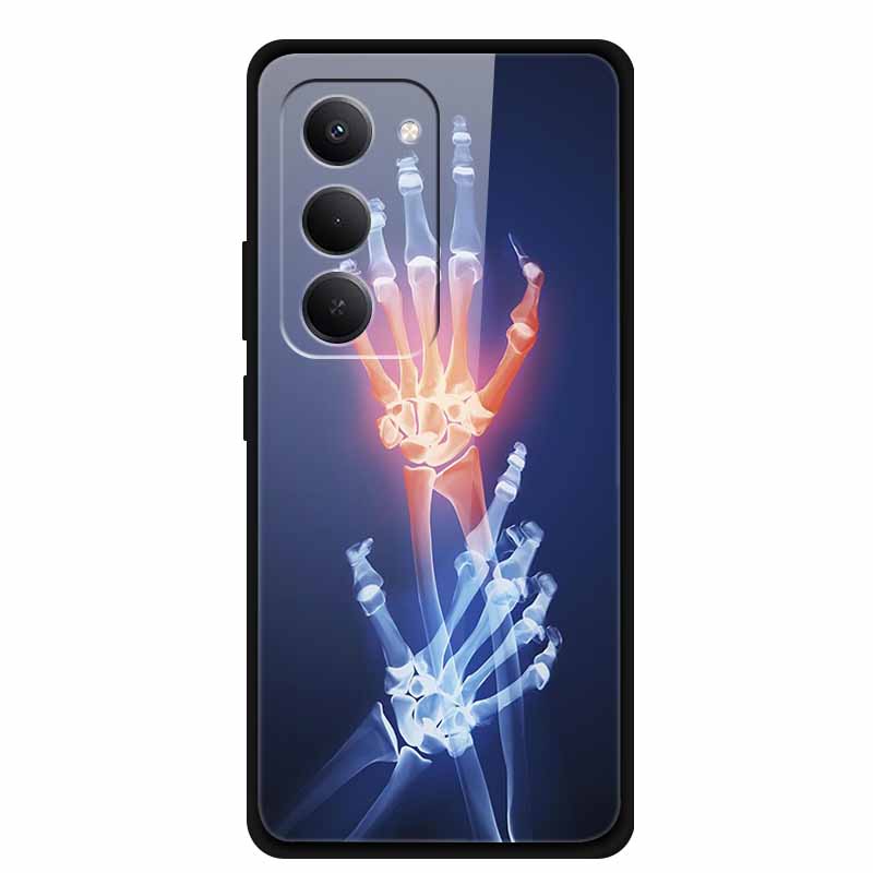 

Glass Case For Redmi 15 4G Phone Case Redmi15 Coque Tempered Glass Hard Back Cover For Xiaomi Redmi 15 5G Case Soft Bumper Funda Redmi 15 4G