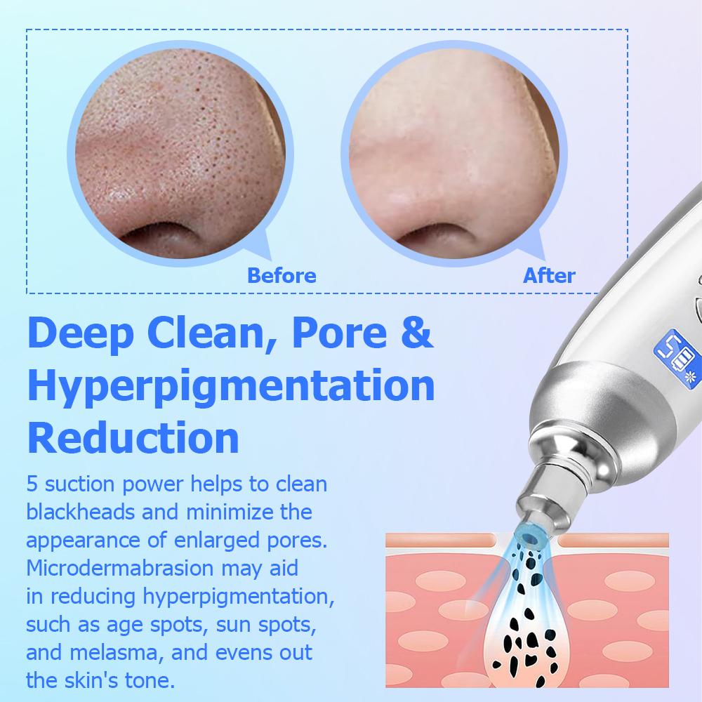 Suction Blackheads God Electric Blackheads Instrument Go Blackheads Face Pore Beauty Face Deep Cleaning Skin Care
