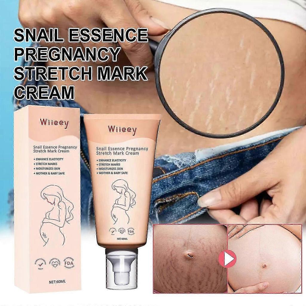 Wiieey Snail Essence Pregnancy Cream Firming Skin Repair Fading Postpartum Pregnancy Marks Pregnancy Obesity Wrinkle Cream Lotion & Moisturizer1pcs) -