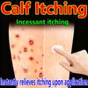 Calf Anti-itching Cream, Suitable for Itchy Calf Skin and Rough Skin