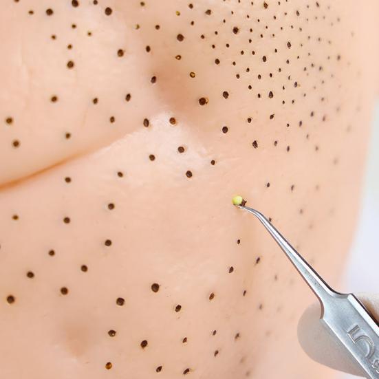 Stresslindrande Pormaskklämleksak med Påfyllning Mänskligt Huvud Akne Klämning Rengöring Fidgetleksak Ansiktssimulator Näs Pormaskborttagning Sensorisk Leksak