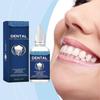 Tooth whitening serum for coffee stains Soothes sensitive gums & teeth. Prevent confidences enhancement