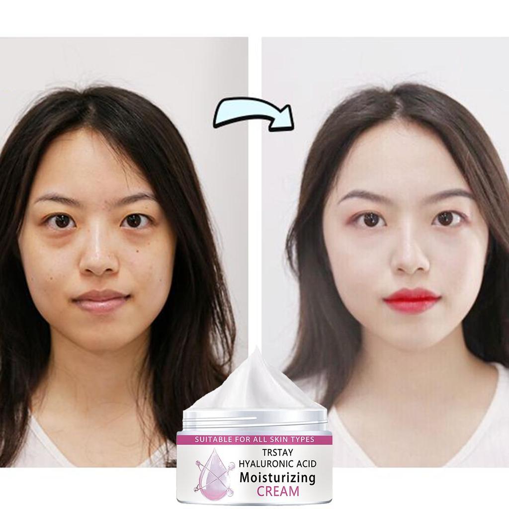 Underarm Legs Knees Whitening Cream Bleaching Body Nourish Skin Whitening Cream Anti Aging Face Cream