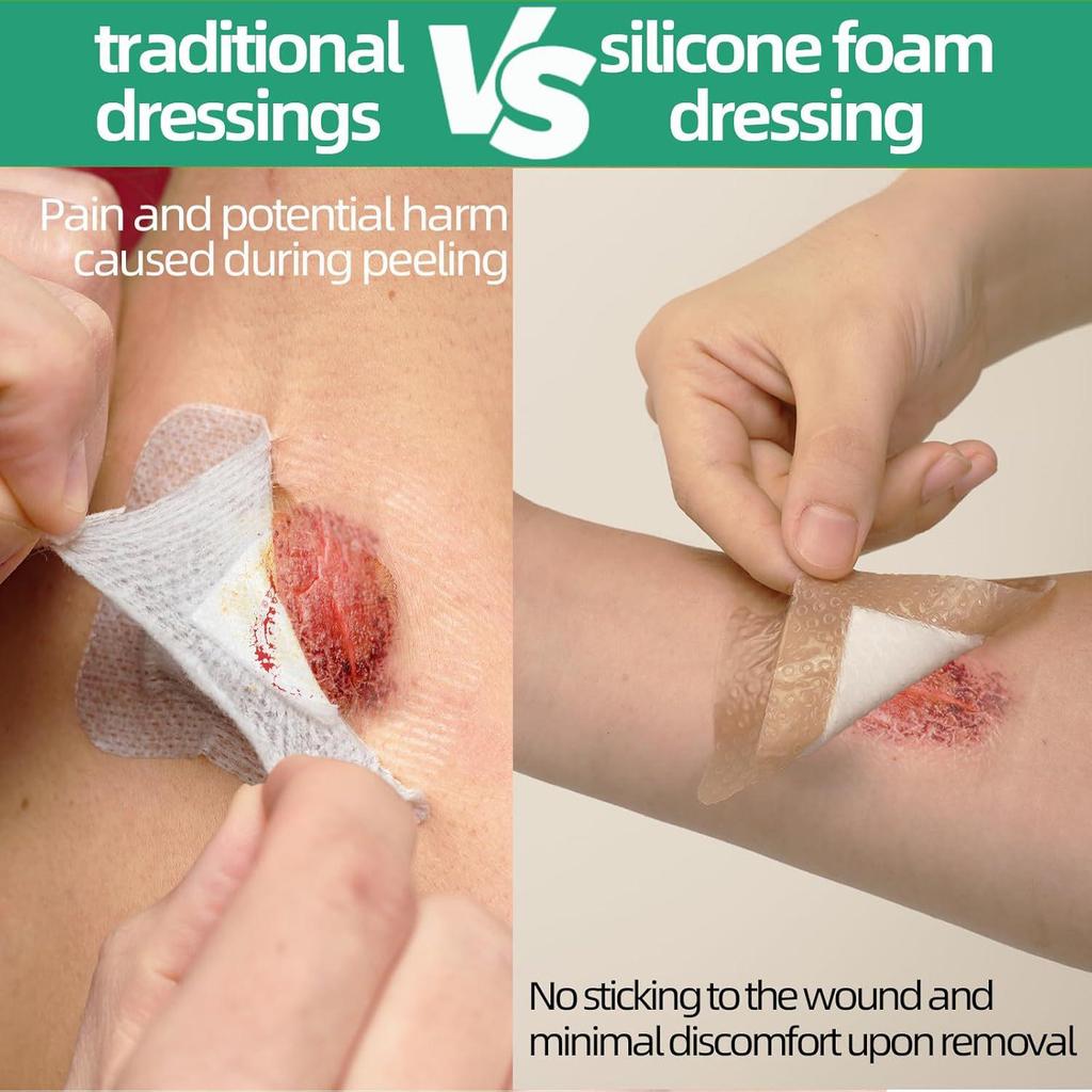 Silicone Gel Foam Dressing for Pressure Ulcer Care - Sterile Polyurethane Foam Patch