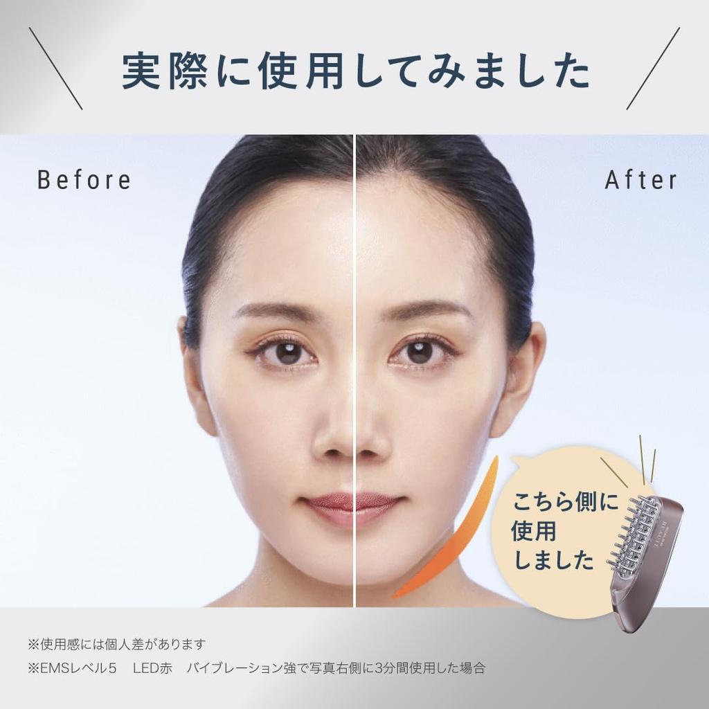 Scalp D Beaute Electric Scalp Scalp Scalp Head Electric Scalp Scalp Facial Beauty Lift Light Gift for Brush, Doctor-Supervised (Anfa Brush, Spa,