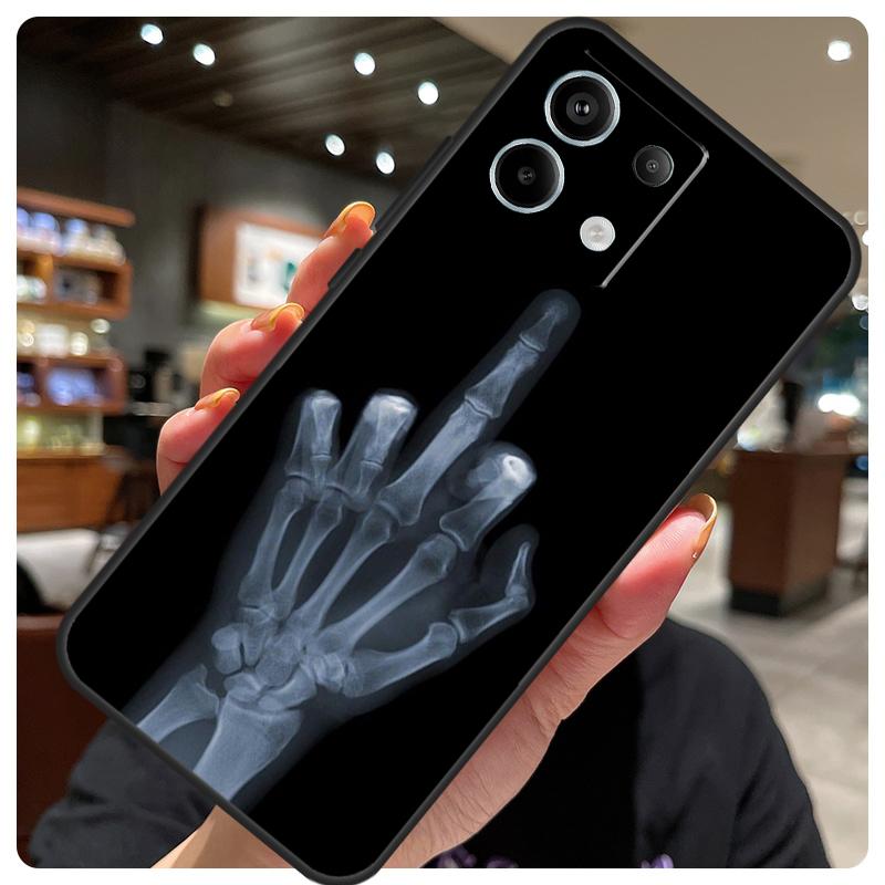 Middle Finger Case For Xiaomi Redmi Note 14 10 13 12 11 15 Pro Plus Cover For Redmi 15 15C 12C 13C 14C 10C