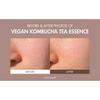 DR.CEURACLE Vegan Kombucha Tea Essence 150ml