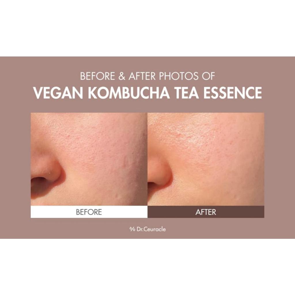 DR.CEURACLE Vegan Kombucha Tea Essence 150ml