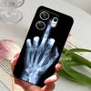 Voor Infinix Zero 30 4G Hoesje Schokbestendig Zacht TPU Siliconen Telefoonhoesje Voor Infinix Zero 30 4G Funda Zero30 X6731B Capa Cartoon
