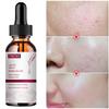 Face Essence Essential Oils Anti Wrinkle Anti-aging Lighten Spots Brightening Facial Skin Fade Remove Freckle Speckle Care