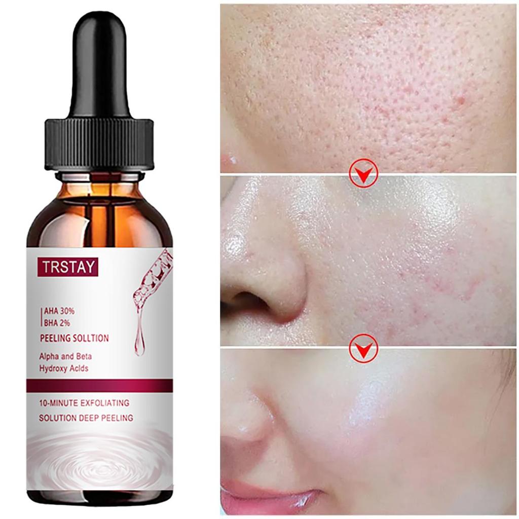 Face Essence Essential Oils Anti Wrinkle Anti-aging Lighten Spots Brightening Facial Skin Fade Remove Freckle Speckle Care