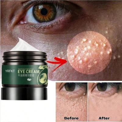 Augencreme gegen Augenringe und Tränensäcke. Natürliche Avocado-Augencreme. Straffende Augencreme