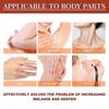 Eelhoe Acanthosis Nigricans Exfoliating Oil Brightens And Brightens The Complexion Of Armpits And Joints, Cleanses And Moisturizes The Skin