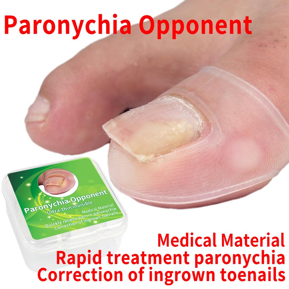 2pcs Silicone Ingrown Toenail Correcting Tool Pain Relief Paronychia Treatment Corrector