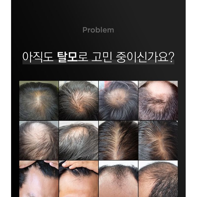 TOSOWOONG Biotin Shampoo