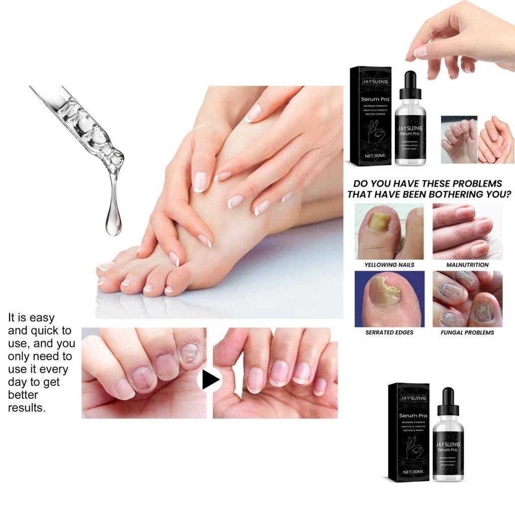 Nourishing Jaysuing Nail Repair Essence For Healthy Strong Nails 30ml