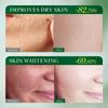 FAYANKOU Lemon Whitening&Brightening Facial Mask Moisturizing&Moisturizing&Brightening Facial Mask