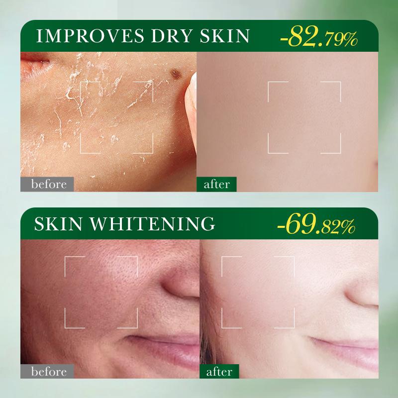 FAYANKOU Lemon Whitening&Brightening Facial Mask Moisturizing&Moisturizing&Brightening Facial Mask