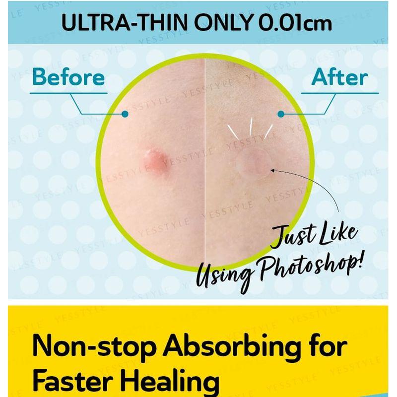 DermaAngel - Denní náplasti na akné s kyselinou salicylovou Plus 24 ks