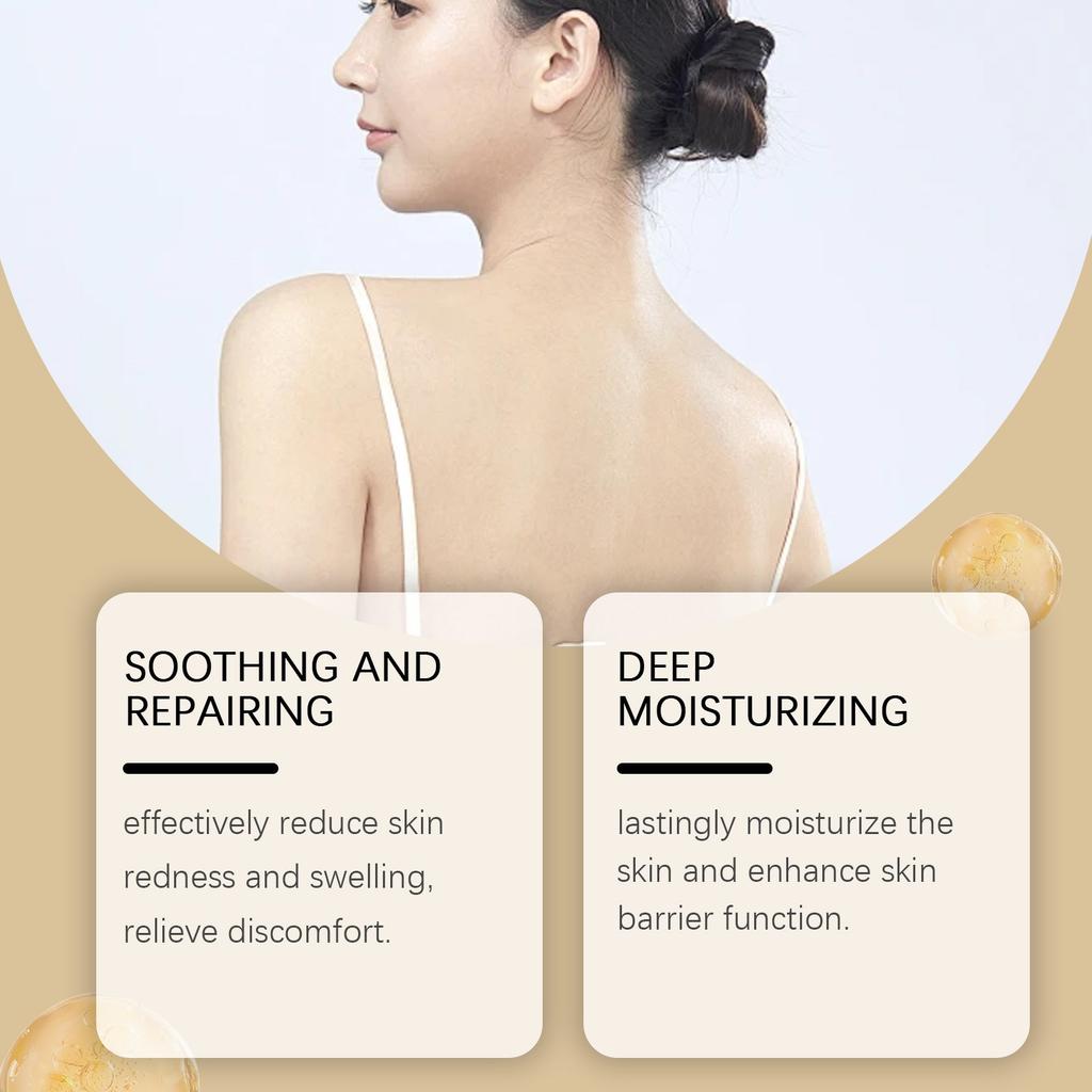 Cremă de îngrijire a pielii cu venin de albine, Cremă calmantă, hidratantă, antiinflamatoare, cu ulei de arbore de ceai