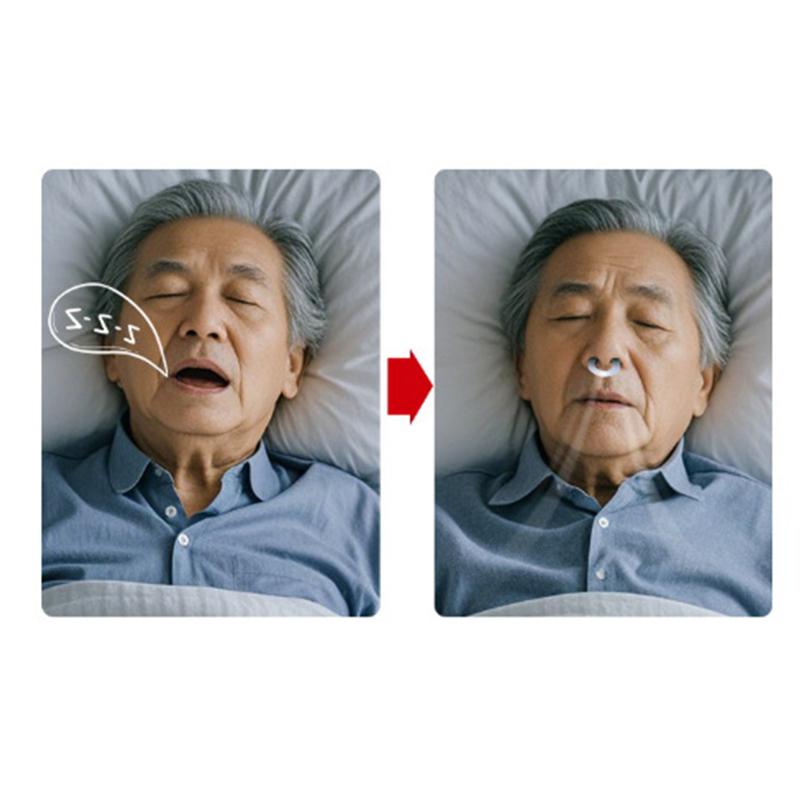 Anti-Snoring Nose Clip Nasal Breathing Dilators Starter Kits Magnetic Nose Increase Sports Air Intake Improve Sleeping