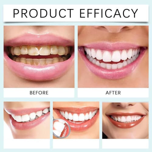 Niacinamide Whitening Toothpaste, Bright White Toothpaste, Niacinamide Toothpaste, Niacinamide Whitening Toothpaste, Fluoride-Free, Gentle Mint, Fresh