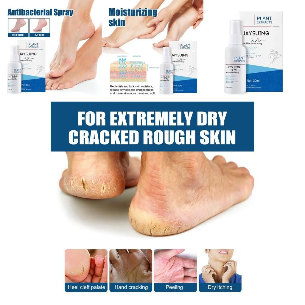 Jaysuing Advanced Foot Care Spray Moisturizes Hydrates And Prevents Dry Cracked Feet And Calluses
