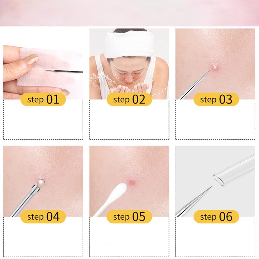 Acne Needle Pore Care Acne Blackhead Blackhead Antibacterial Stainless Beauty Storage Case Portable 4-Piece Set, Kit, Remover, Remover, Pusher, Steel,