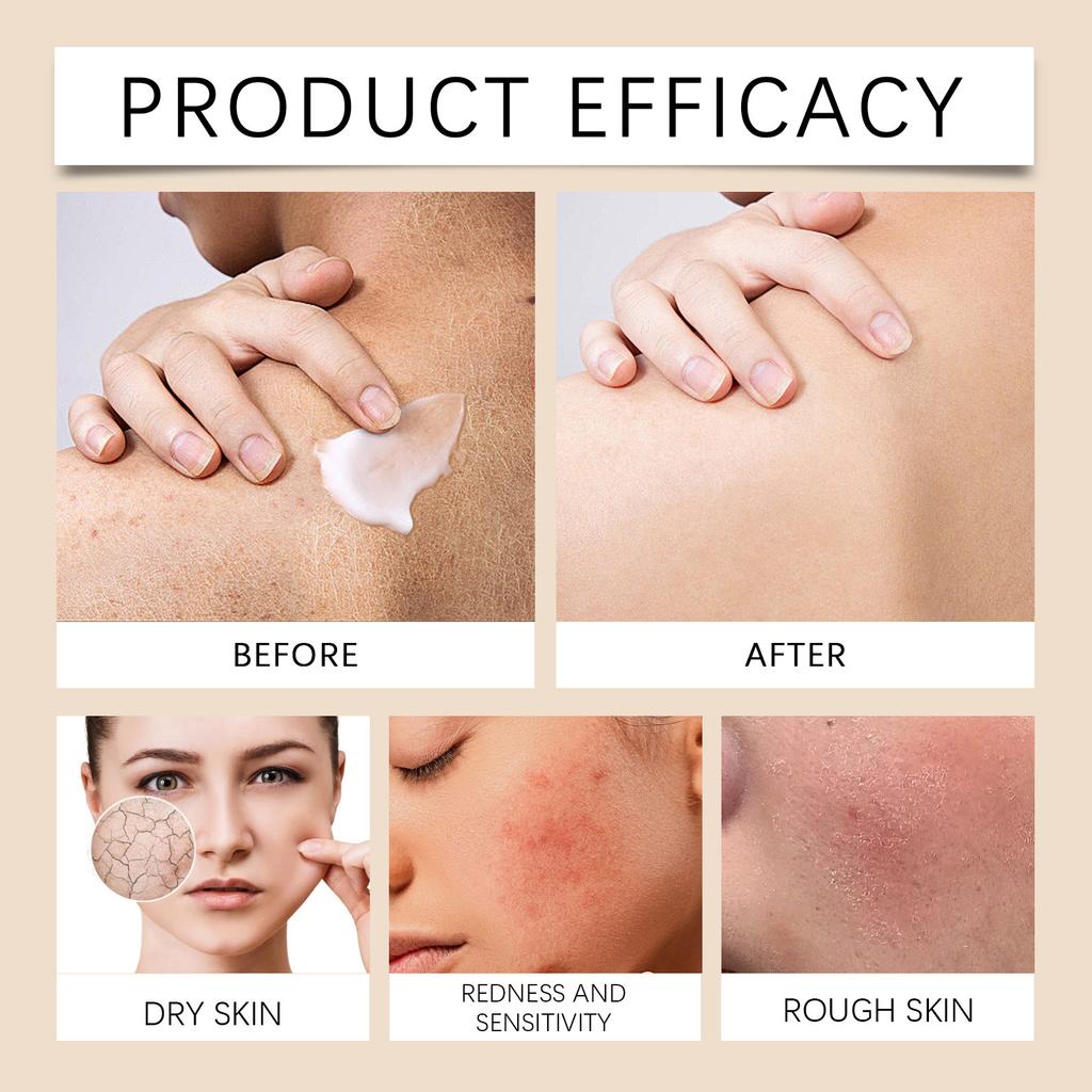 Multifunctional Skin Moisturizer Deeply Moisturizes And Locks In Moisture To Moisturize Dry, Cracked, Red, Sensitive And Comfortable Skin Care.