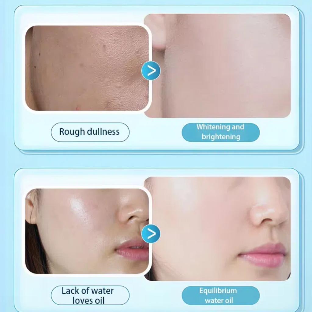 Smoothie Soothing Jelly Mask Moisturizing and Soothing Ceramide NP Witch Hazel Summer After Sun Repair Mask & Cool Deep Hydrating Mask