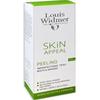 Louis Widmer Skin Appeal Pīlings 50 ml