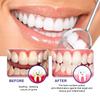 Tooth Whitening Foam Mousse Prevent Periodontitis Toothache Relief Dental Calculus Stain Removal Repair Gums Decay Oral Hygiene