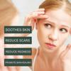 Woodsleep Calendula Care Essential Oil Reduces Scar Skin Redness, Moisturizes, Smooths And Tightens The Skin