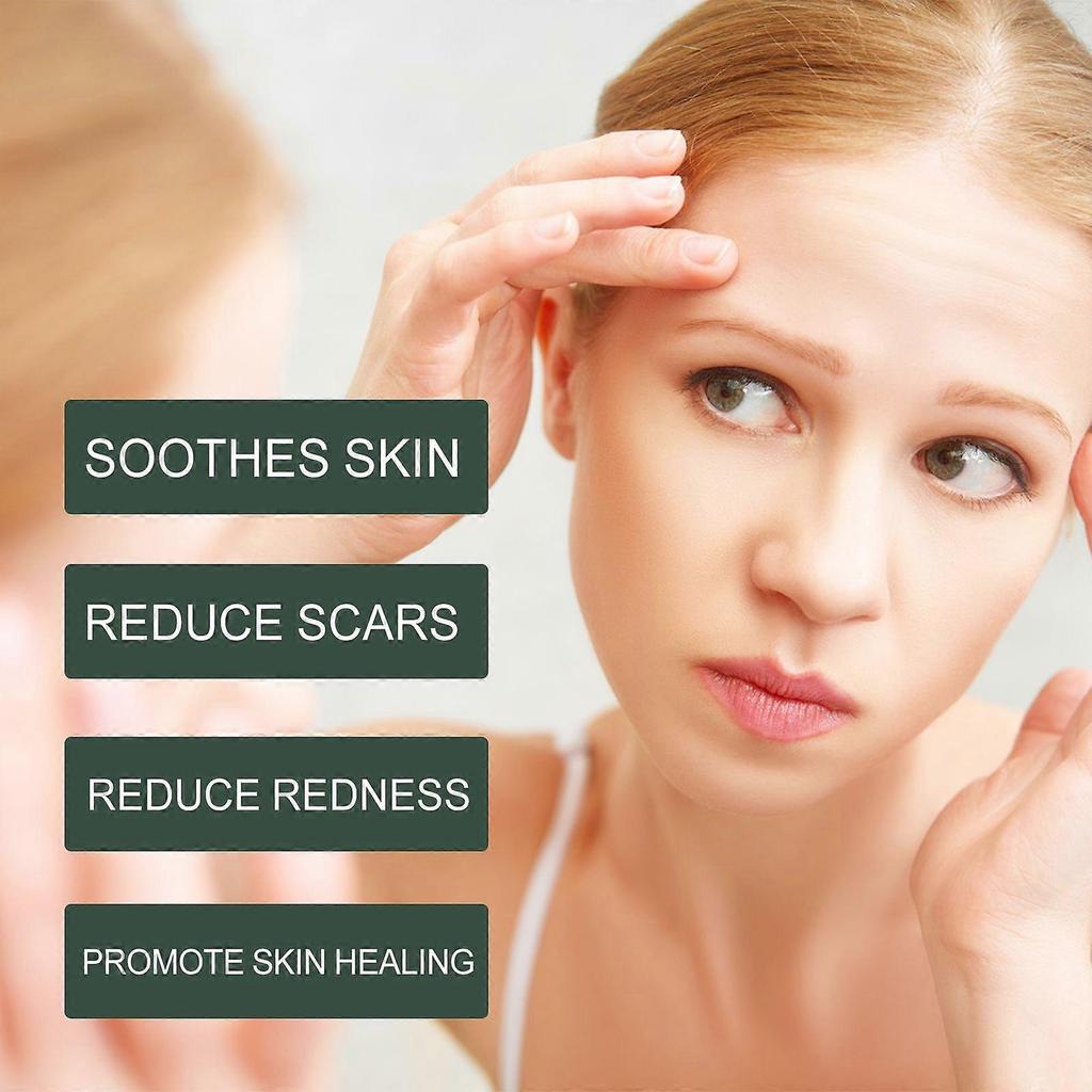 Woodsleep Calendula Care Essential Oil Reduces Scar Skin Redness, Moisturizes, Smooths And Tightens The Skin