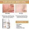 Eelhoe Turmeric Correction Essence Facial Care Hydrating And Moisturizing Gentle Skin Care Essence