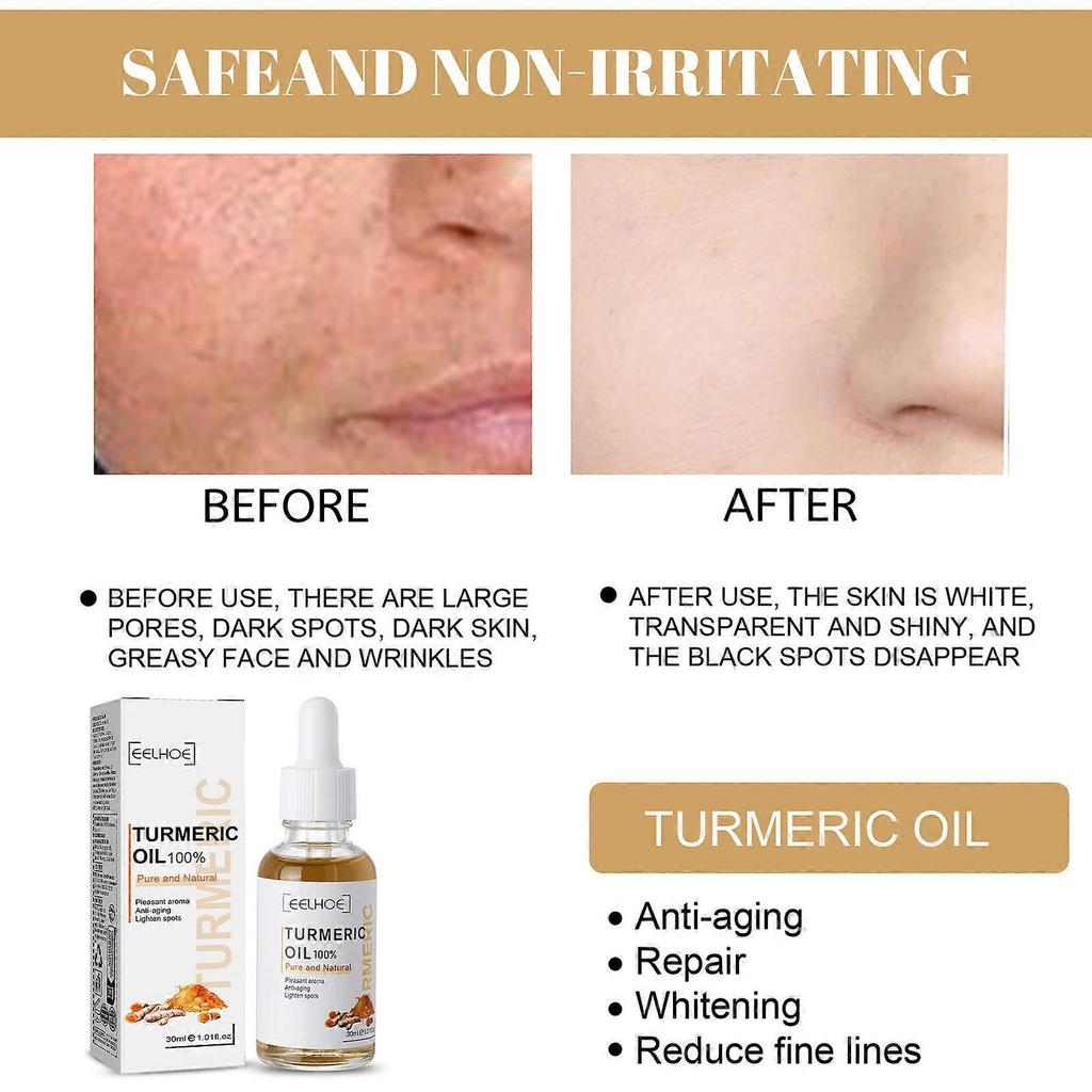Eelhoe Turmeric Correction Essence Facial Care Hydrating And Moisturizing Gentle Skin Care Essence